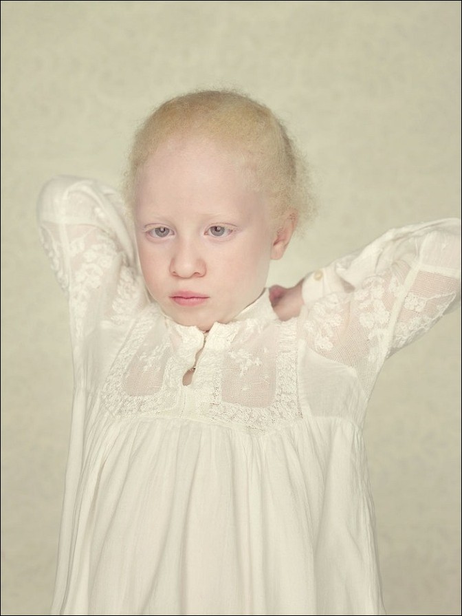 albino16 – kopie